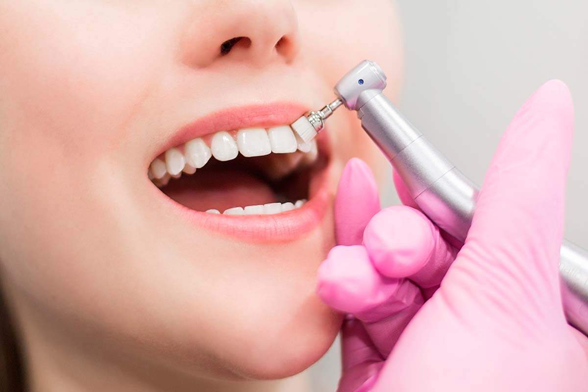 Limpieza y mantenimiento dental