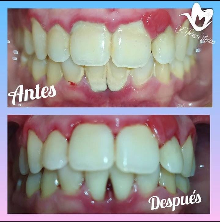 Periodoncia